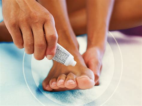 Nail Fungus Under Acrylic Nails at Raymond Eudy blog
