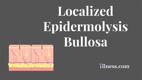Epidermolysis Bullosa Age Expectancy