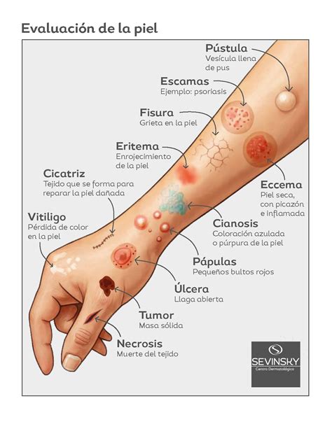Enfermedades De La Piel
