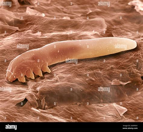 Eyelash mite. Coloured scanning electron micrograph (SEM) of an eyelash ...