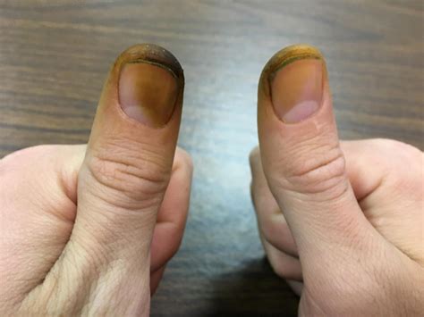 Fruit Trees - Home Gardening Apple, Cherry, Pear, Plum: Black Walnut ...