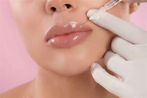 6 Common Lip Conditions and How Lip Fillers Can Treat Them - SL Aesthetic Clinic