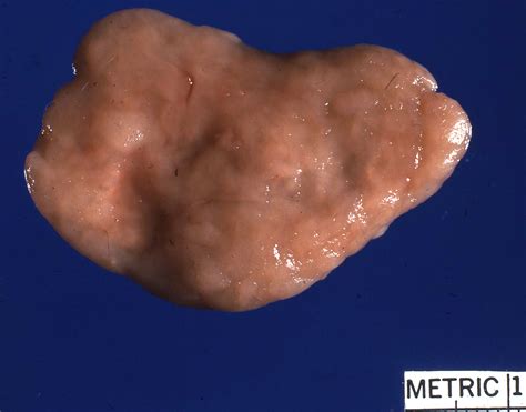 Hippomanes - Pathology and Ponies