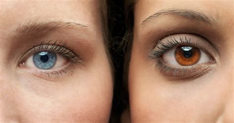 Surgery To Change Your Eye Color | Renew Physical Therapy