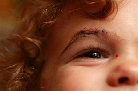 How Much Do CT Scans Cost Without Insurance | LiveWell