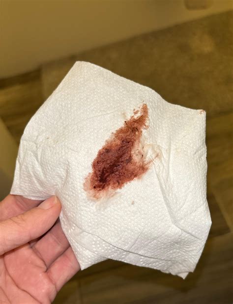 Brown Discharge After Period Brown Discharge Before A Period:12 Causes