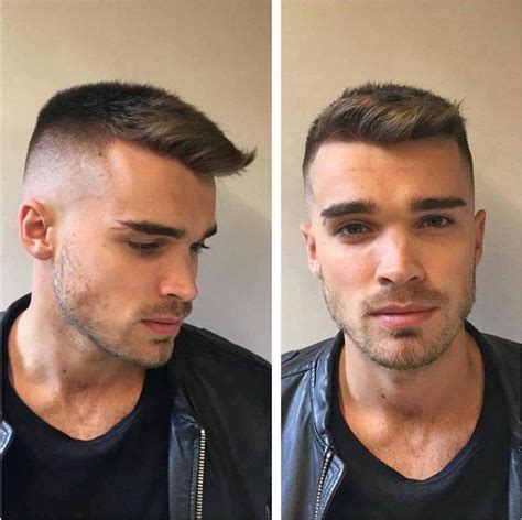 Men's Hairline Types at Marlene Walsh blog