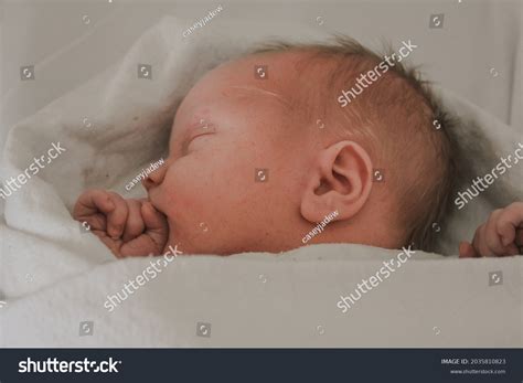 3 Blood Vessel Finger Burst Images, Stock Photos, 3D objects, & Vectors | Shutterstock