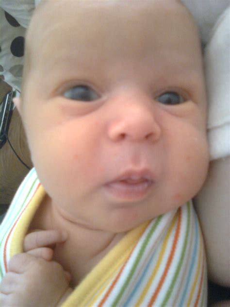 My Nipples Are Sore And Cracked From Breastfeeding - diamond dental ...