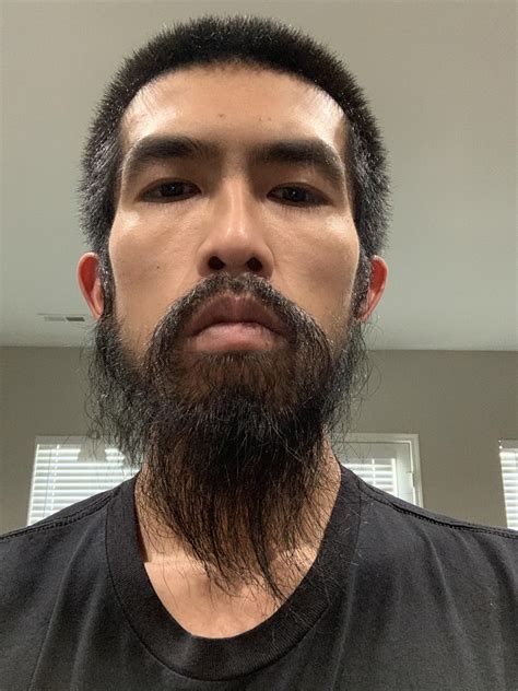 Minoxidil Beard Asian
