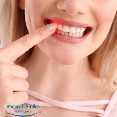 Gum Diseases Explained: Signs, Risks, And Treatments