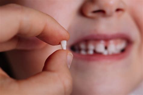 Willis Family Dental | Baby Tooth Extraction