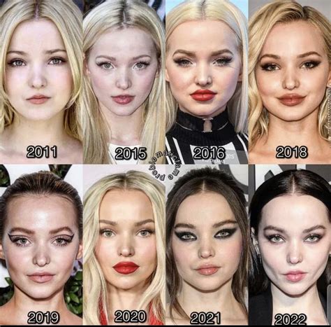 Pin by K Lightning on Celeb Changing Faces/Bodies | Celebrity plastic surgery, Celebrities, Dove ...