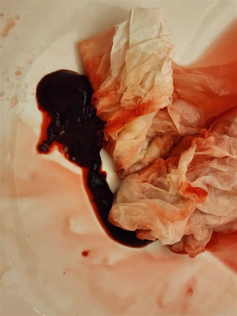 Irregular period/ : r/period