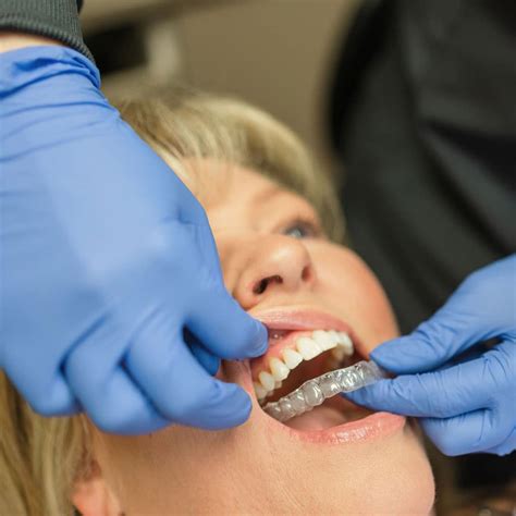 Dental Narrative For Occlusal Guard at Brain Ervin blog