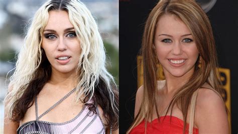 Miley Cyrus Teeth Before After