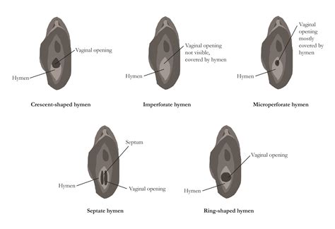 What does a normal vagina look like? A no nonsense guide to vaginas and vulvas | Woman & Home