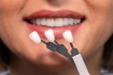 How Veneers Can Instantly Transform Your Smile - A Dental Center