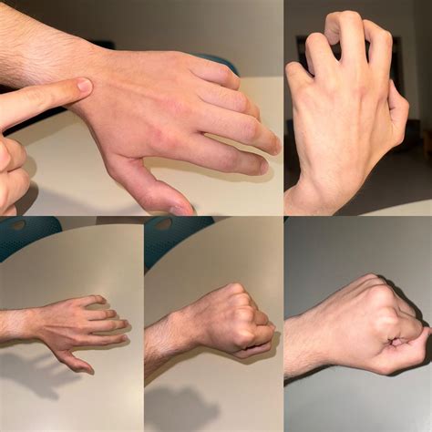 Advice for wrist/knuckle pain (musician) : r/ehlersdanlos