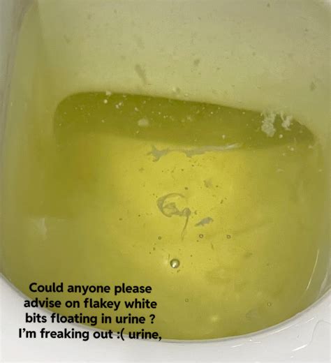 White Mucus In Urine Rapeseed #cropprotection #pestmonitoring ...