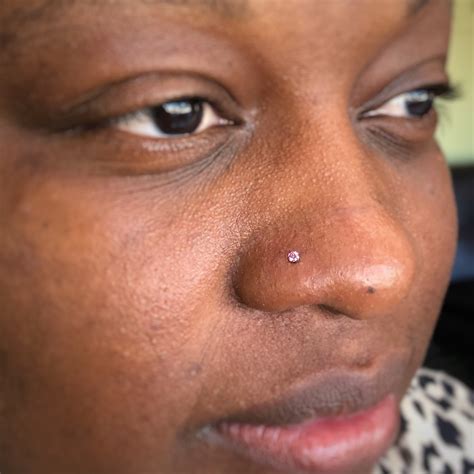 Nostril Piercing Infection
