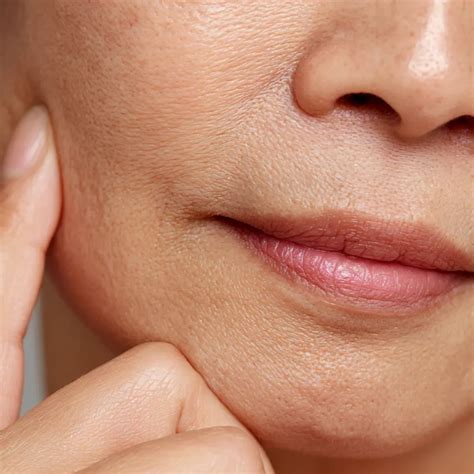 What Helps Crepey Skin? Causes and Treatments Explained