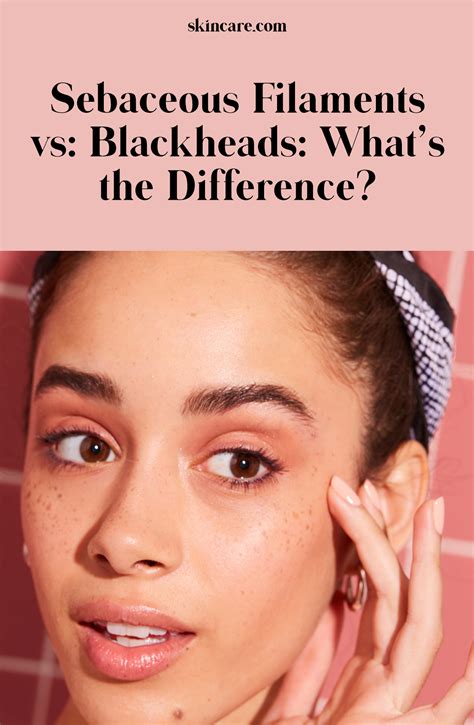 Sebaceous filaments vs blackheads what s the difference – Artofit