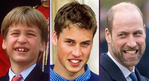 A look at Prince William's iconic hair - from bowl cuts to baldness