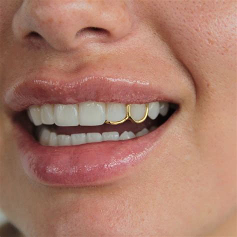 Single Gold Tooth Cap