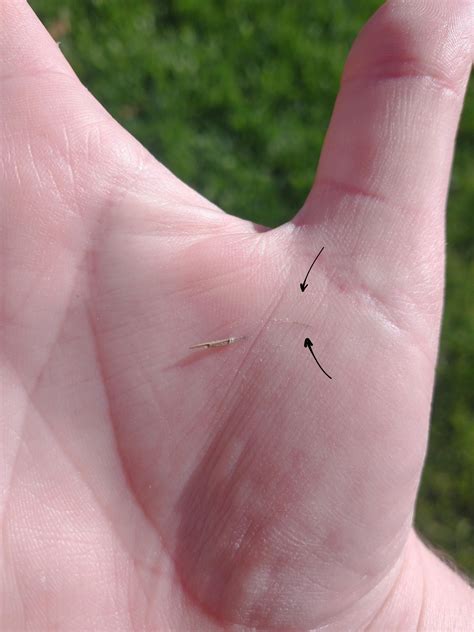 Well... That sucks...