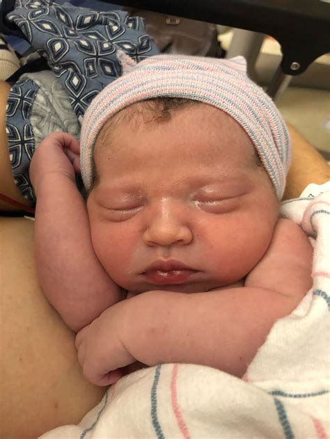 Pediatric Pearls: Infant's Eye Part 1 - Red Spots, Puffy Eyes, Big Eyes