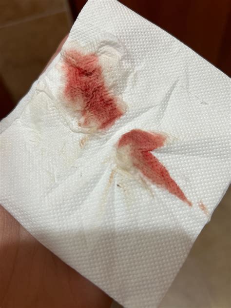 Sangrado de implantación | BabyCenter