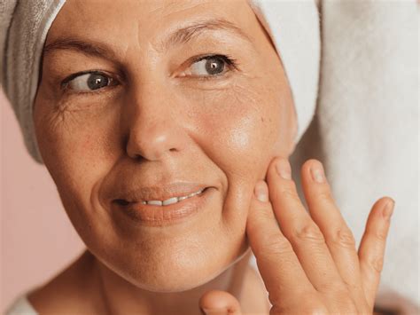 Spider Veins On Face