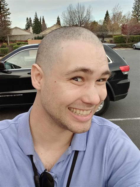 [CW: bald patches, close-ups of hair] I shaved my head! : r/trichotillomania