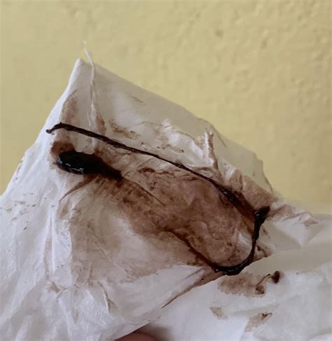 Does implantation bleeding have clots? : r/period