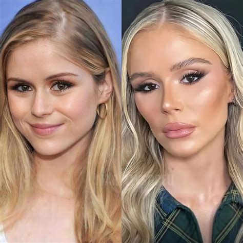 Erin Moriarty Surgery
