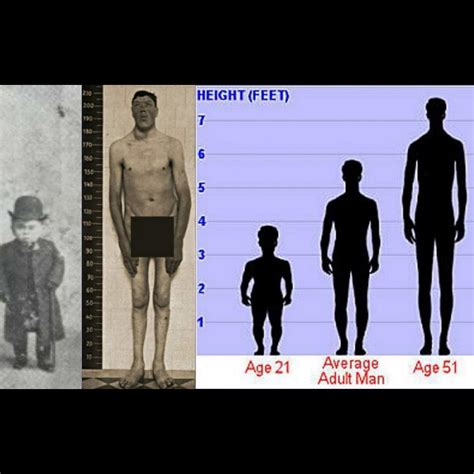 Dwarfism And Gigantism