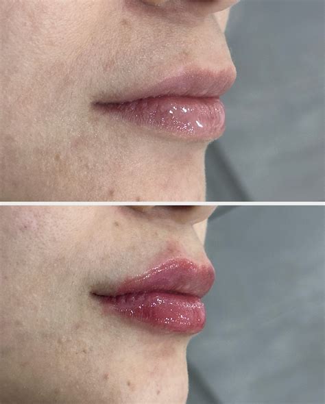 Dra. Melissa Mercado | Dermatóloga (@dermatie.clinic) • Instagram photos and videos