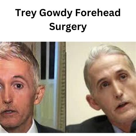 Trey Gowdy Face Surgery