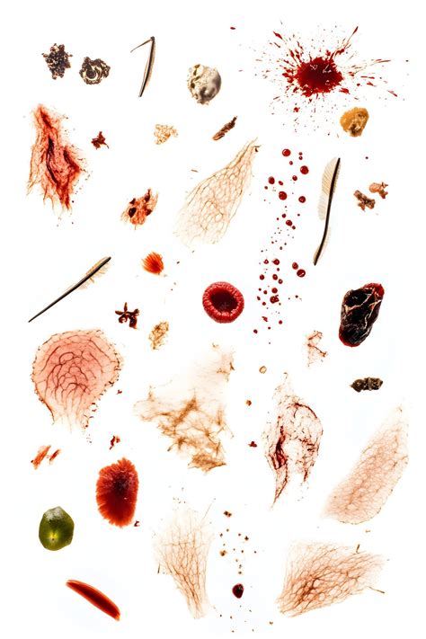 Comprehensive Illustration of Various Wound Types Abrasions Lacerations ...