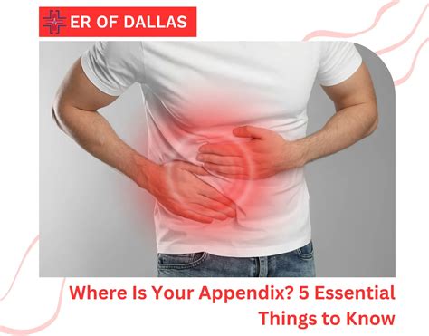 Where Is Your Appendix? 5 Essential Things to Know