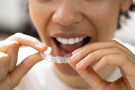 Does Medicaid Cover Invisalign? And Other Treatment Funding Options ...