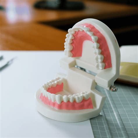 Best Crown For Teeth In India at Thomas Russo blog