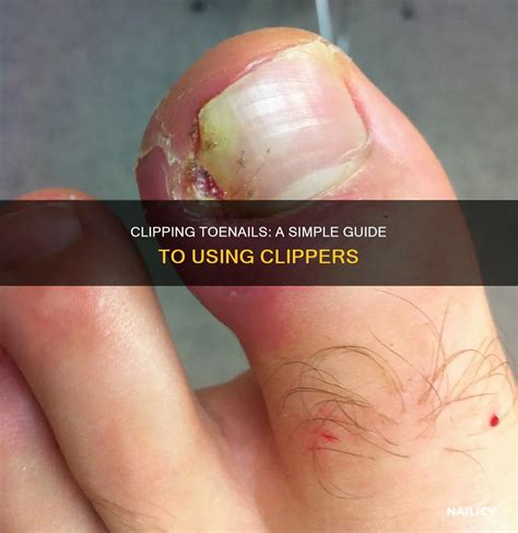 Clipping Toenails: A Simple Guide To Using Clippers | Nailicy