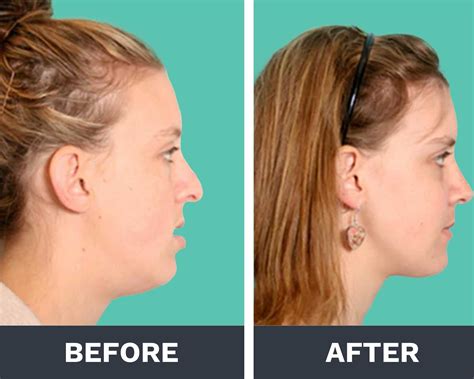 Haki Sleep Mouth Tape