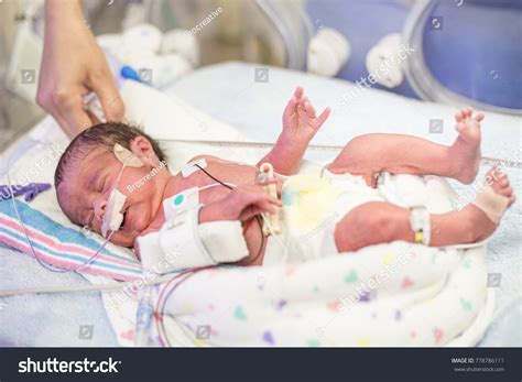 940 Baby In Nicu Images, Stock Photos & Vectors | Shutterstock