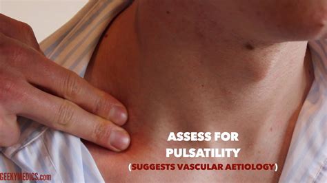 Male Lump On Left Side Of Neck at Erin Ayers blog