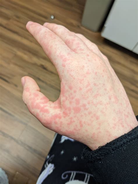 Miss Universe #ENVTuber on Twitter: "TIL squid is a shellfish. Calamari is regretfully delicious ...