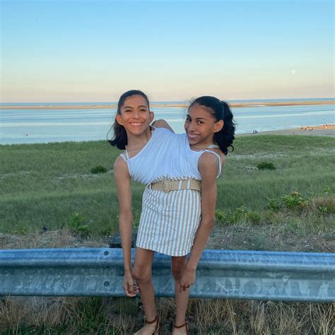 We’re conjoined twins — but only one of us has a boyfriend