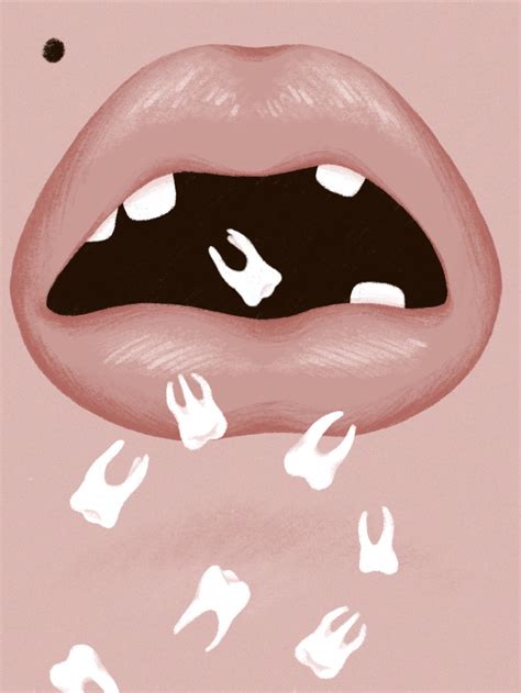 13 Reasons For Dreams When Your Teeth Fall Out | Teeth falling out dream, Dreams about teeth ...